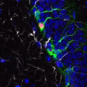 Neural stem cells