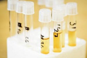Vials of yeast samples