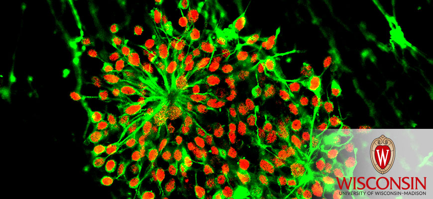 Stem Cells