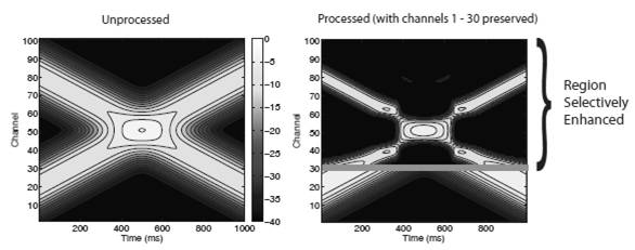 The decomposed synthetic acoustic signal shown on the left is unprocessed, while the signal on the right has been selectively processed as a result of the contrast enhancement algorithm.