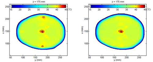 On the left, the figure depicts two additional hot spots resulting from conventional microwave hyperthermia. On the right, the new method demonstrates no hot spots beyond the intended target.